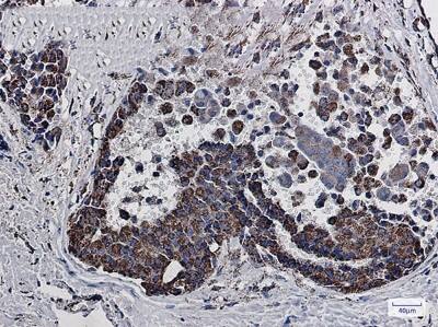 Immunohistochemistry-Paraffin: MDH2 Antibody (S06-4E2) [NBP3-19685]