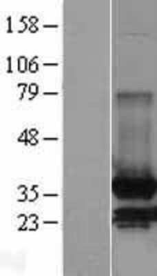 Western Blot: MDH2 Overexpression Lysate [NBL1-12966]