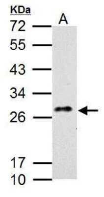 Western Blot: MDL-1/CLEC5A Antibody [NBP2-43607]