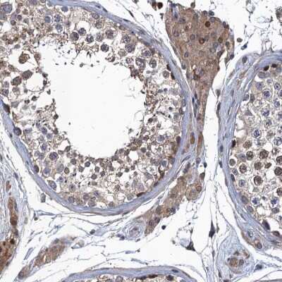 Immunohistochemistry-Paraffin: MDM1 Antibody [NBP1-86242]