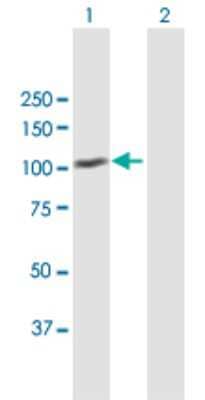 Western Blot: MDM1 Antibody [H00056890-B01P]