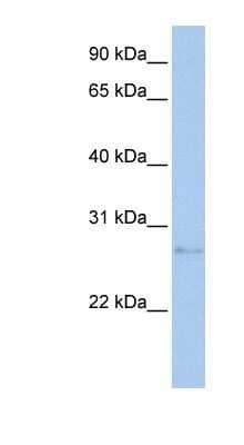 Western Blot: MDM1 Antibody [NBP1-59376]