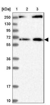 Western Blot: MDM1 Antibody [NBP1-85839]