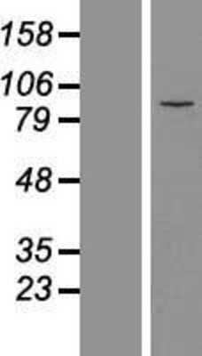 Western Blot: MDM1 Overexpression Lysate [NBL1-12969]