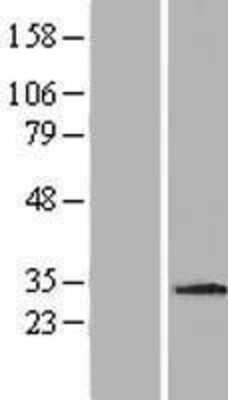 Western Blot: MDM1 Overexpression Lysate [NBP2-06693]