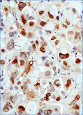 Immunohistochemistry: MDM2/HDM2 Antibody (SMP14) - Azide and BSA Free [NBP2-80845]
