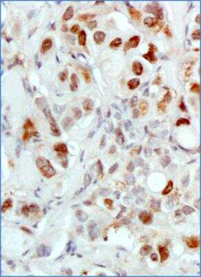 Immunohistochemistry-Paraffin: MDM2/HDM2 Antibody (SMP14) - BSA Free [NB100-2736]