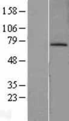 Western Blot: MDM2/HDM2 Overexpression Lysate [NBL1-12970]