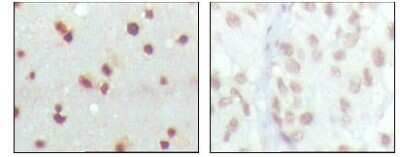 Immunohistochemistry-Paraffin: MDMX Antibody (2D10F4) - BSA Free [NBP1-28862]