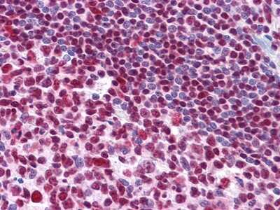 Immunohistochemistry-Paraffin: MDMX Antibody (2D10F4) - BSA Free [NBP1-28862]