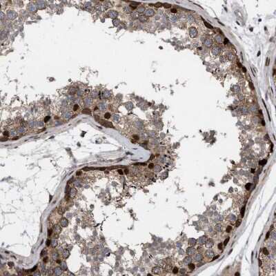 Immunohistochemistry-Paraffin: MDMX Antibody [NBP1-87733]