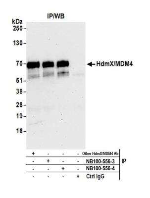 Immunoprecipitation: MDMX Antibody [NB100-556]