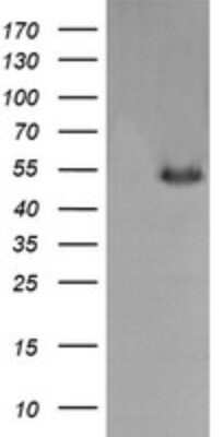 Western Blot: MDMX Antibody (OTI4G5)Azide and BSA Free [NBP2-72605]