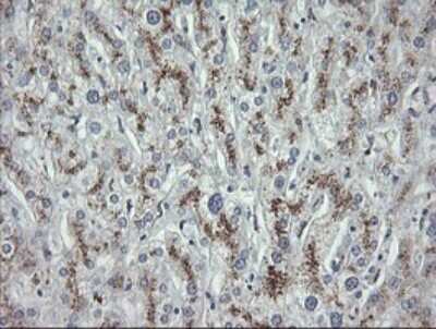 Immunohistochemistry: MDMX Antibody (OTI4G5) [NBP2-45779]