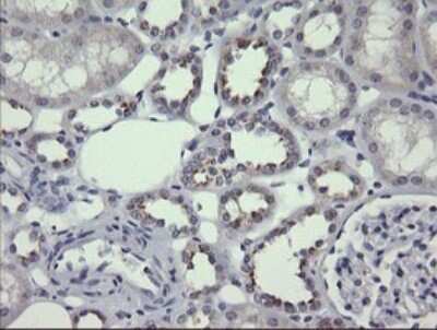 Immunohistochemistry: MDMX Antibody (OTI4G5) [NBP2-45779]