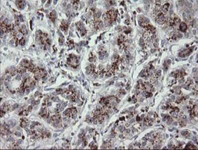 Immunohistochemistry: MDMX Antibody (OTI4G5) [NBP2-45779]