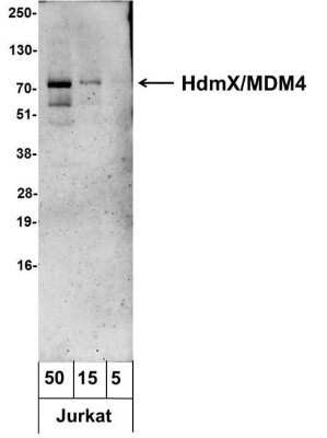 Western Blot: MDMX Antibody [NB100-556]