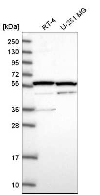 Western Blot: MDMX Antibody [NBP2-58791]