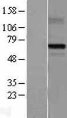 Western Blot: MDMX Overexpression Lysate [NBL1-12971]