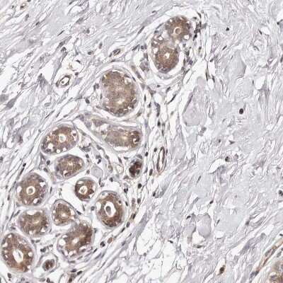 Immunohistochemistry: MDP1 Antibody [NBP1-83431]