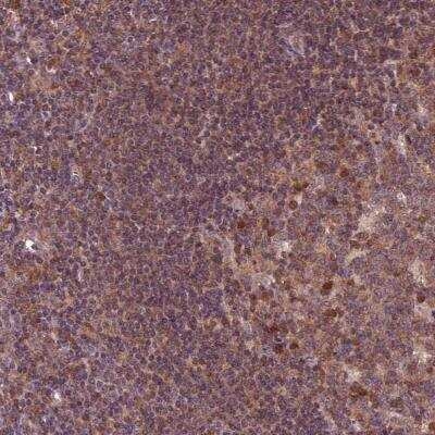 Immunohistochemistry: MDP1 Antibody [NBP2-56371]