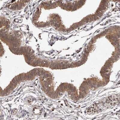 Immunohistochemistry-Paraffin: MDP1 Antibody [NBP1-83431]
