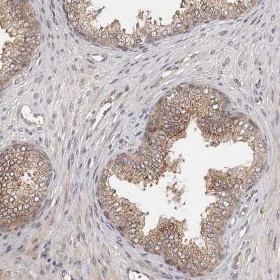 Immunohistochemistry-Paraffin: MDP1 Antibody [NBP1-83431]