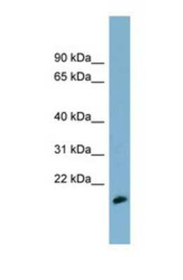 Western Blot: MDP1 Antibody [NBP1-56573]