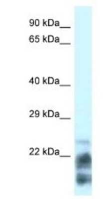 Western Blot: MDP1 Antibody [NBP1-56573]