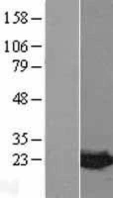 Western Blot: MDP1 Overexpression Lysate [NBL1-12972]