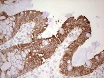 Immunohistochemistry: MDR1/ABCB1 Antibody (OTI1A7) [NBP2-46466]