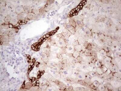 Immunohistochemistry: MDR1/ABCB1 Antibody (OTI1A7) [NBP2-46466]