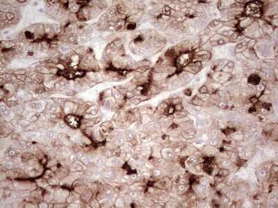Immunohistochemistry: MDR1/ABCB1 Antibody (OTI1A7) [NBP2-46466]