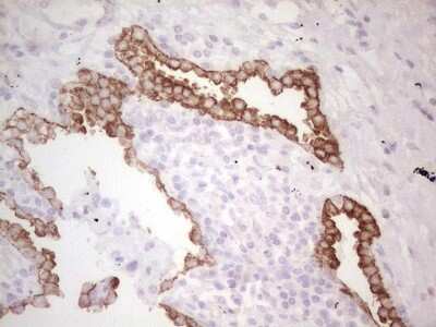Immunohistochemistry: MDR1/ABCB1 Antibody (OTI1A7) [NBP2-46466]