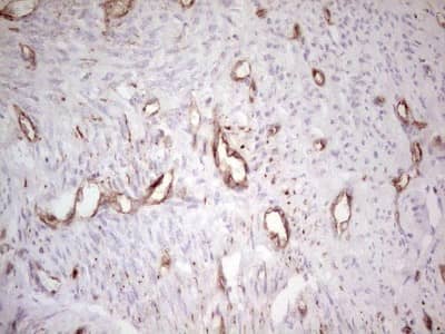 Immunohistochemistry: MDR1/ABCB1 Antibody (OTI1A7) [NBP2-46466]