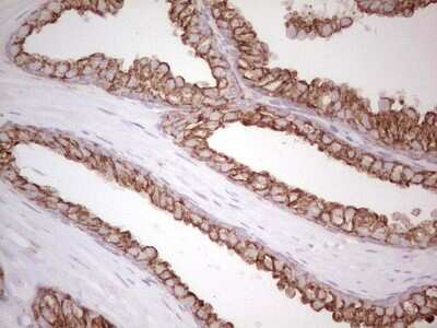 Immunohistochemistry: MDR1/ABCB1 Antibody (OTI1A7) [NBP2-46466]