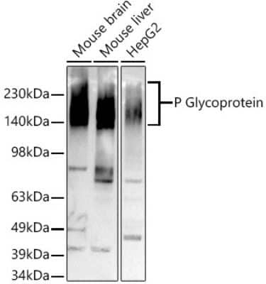 Western Blot: MDR1/ABCB1 Antibody (2U4E9) [NBP3-15660]