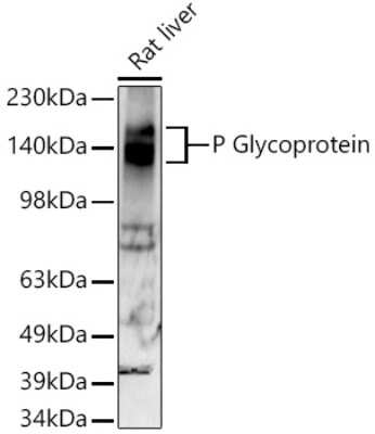 Western Blot: MDR1/ABCB1 Antibody (2U4E9) [NBP3-15660]