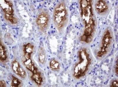 Immunohistochemistry: MDR1/ABCB1 Antibody (OTI3B2) [NBP2-46465]
