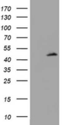 Western Blot: MDR1/ABCB1 Antibody (OTI3B2) [NBP2-46465]