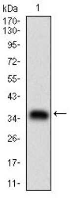 Western Blot: MDR1/ABCB1 Antibody (6G11F8)BSA Free [NBP2-37290]