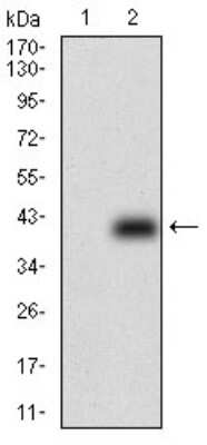 Western Blot: MDR1/ABCB1 Antibody (6G11F8)BSA Free [NBP2-37290]