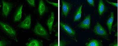 Immunocytochemistry/ Immunofluorescence: MDR1/ABCB1 Antibody [NBP2-17251]