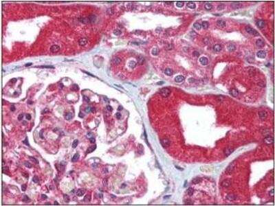 Immunohistochemistry-Paraffin: MDR1/ABCB1 Antibody - BSA Free [NB100-80870]