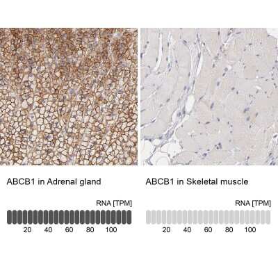 Immunohistochemistry-Paraffin: MDR1/ABCB1 Antibody [NBP1-90291]