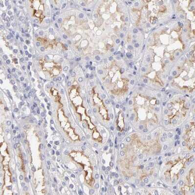 Immunohistochemistry-Paraffin: MDR1/ABCB1 Antibody [NBP1-90291]