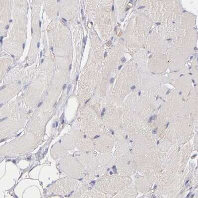 Immunohistochemistry-Paraffin: MDR1/ABCB1 Antibody [NBP1-90291]