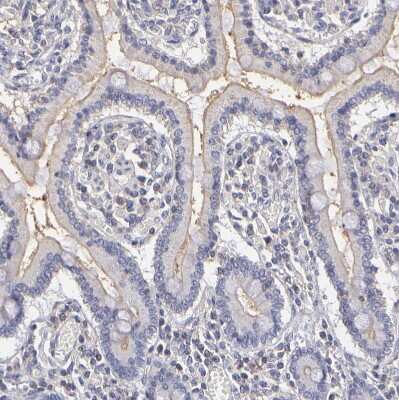 Immunohistochemistry-Paraffin: MDR1/ABCB1 Antibody [NBP1-90291]