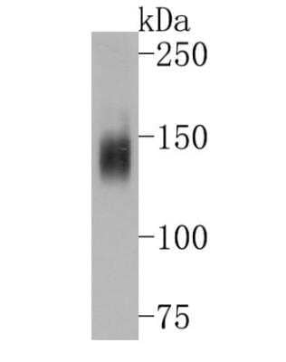 Western Blot: MDR1/ABCB1 Antibody (SN06-42) [NBP2-67667]