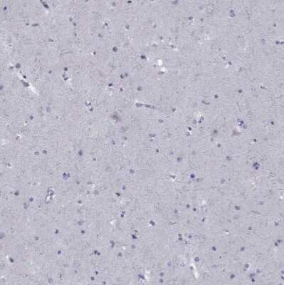 Immunohistochemistry-Paraffin: MDR3/ABCB4 Antibody [NBP2-30876]